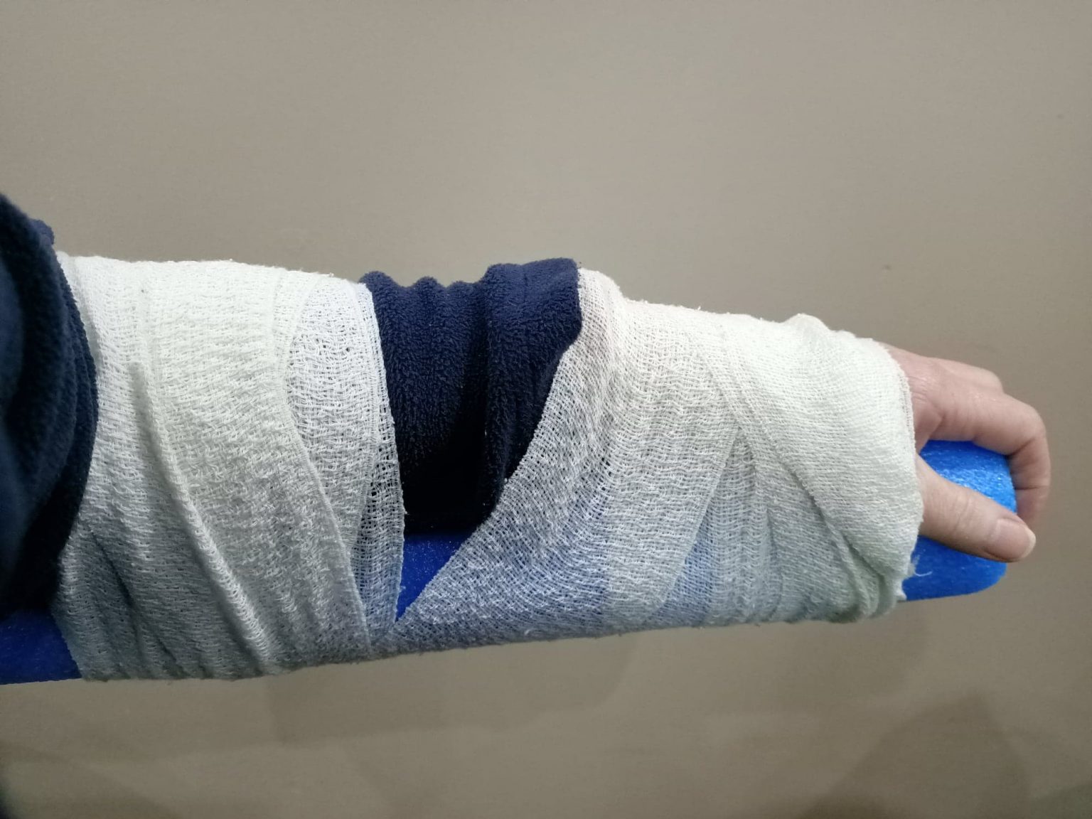 Bandage on arm