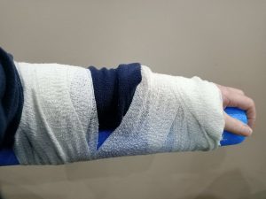 Bandage on arm