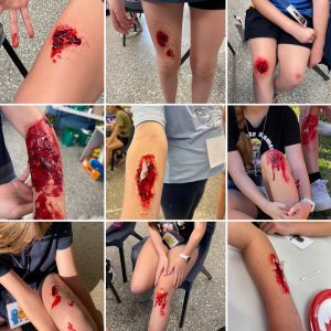 Pretend knee wounds